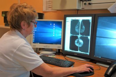 Levočská nemocnica upozorňuje na dôležitosť preventívnych mamografických vyšetrení  